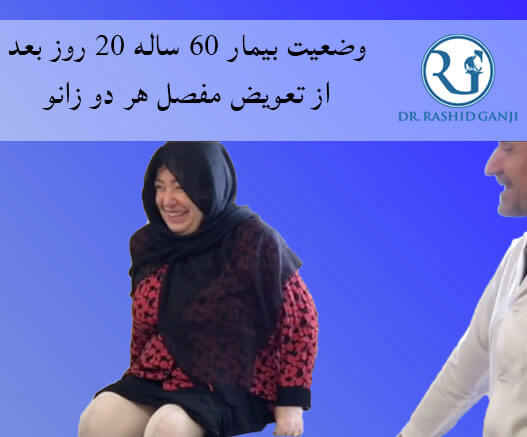 بهترین دکتر زانو ایران