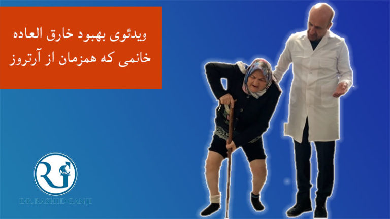 بهترین دکتر زانو ایران