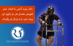 بهبود بیمار با زانوی پرانتزی و خمیدگی 62 درجه! به کمک تعویض مفصل زانو | فيلم جراحي زانو کلیپ بازیابی جراحی مفصل زانو